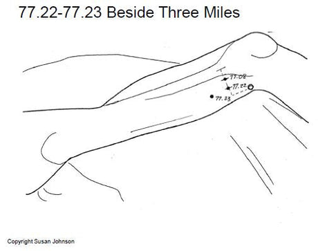 Master Tung's Beside Three Miles for Shao Yang type migraine, and other issues of the head & face