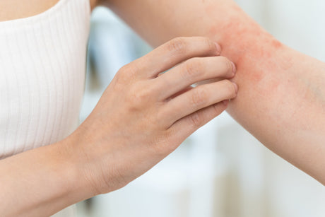 Seasonal Skin “Allergies” and the Search for Balance