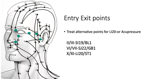 Facial Acupuncture in a time of Masks