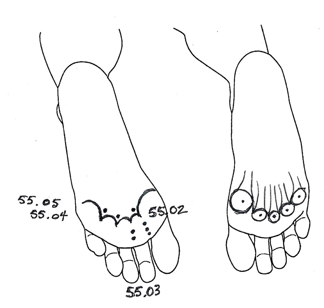 drawing of two feet showing the insertion location for the acupuncture points commonly called flowerbone points