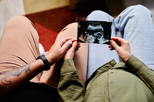 Photo of a two people looking at an ultrasound of a baby