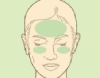 Diagram of a head indicating common places for headaches in the forehead and eyes