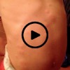 photo of child's stomach with hives